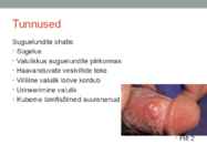 Herpes ehk ohatis esitlus #3