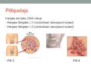 Herpes ehk ohatis esitlus #4
