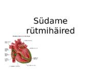 Südame rütmihäired