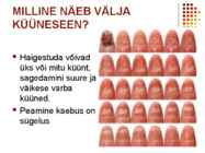 Käeseen #19