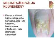 Käeseen #20