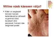 Käeseen #5