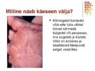 Käeseen #6