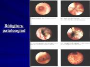 Gastroenteroloogia e-seedeelundite haigused #39