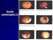 Gastroenteroloogia e-seedeelundite haigused #64
