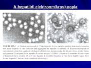 Gastroenteroloogia e-seedeelundite haigused #76