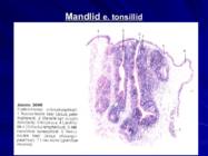 Gastroenteroloogia e-seedeelundite haigused #9