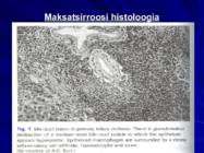 Gastroenteroloogia e-seedeelundite haigused #82