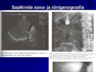 Gastroenteroloogia e-seedeelundite haigused #93