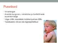 Leetrid-mumps-punetised ESITLUS #3