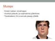 Leetrid-mumps-punetised ESITLUS #4