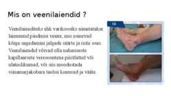 Veenilaiendid #2