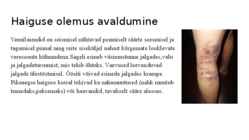 Veenilaiendid #6
