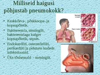 Pneumokokk #6