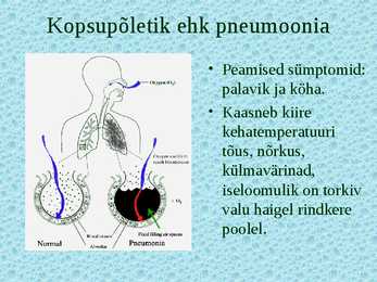 Pneumokokk #8