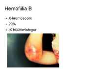 Hemofiilia #5