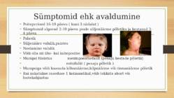 Mumps #4