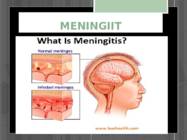 Meningiit #8