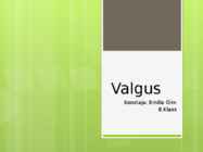 Valgus