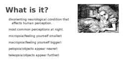 Alice in Wonderland syndrome-AIWS- Todd’s syndrome #3