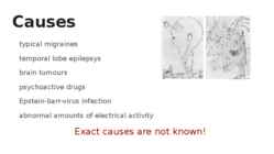 Alice in Wonderland syndrome-AIWS- Todd’s syndrome #4
