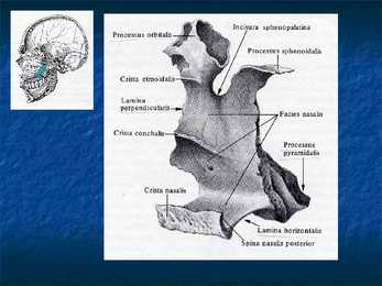 Cranium #19