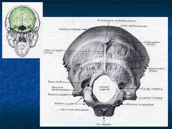 Cranium #3