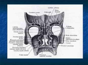 Cranium #23