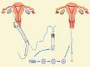 Embrüosiirdamine inimesel #6