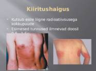 Radioaktiivse kiirguse mõju inimorganismile #10