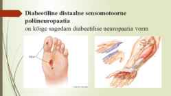 Diabeetiline neuropaatia #5