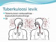 Tuberkuloos #7