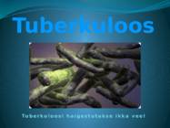 Tuberkuloos
