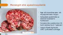 Meningiit ehk ajukelmepõletik #2