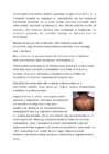 Anaboolsed steroidid-Meessuguhormoonid ja doping-Noored ja jõusaalide ohud #2