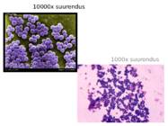 Staphylococcus aureus #5