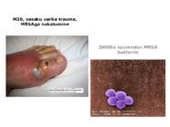 Staphylococcus aureus #10