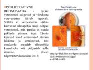 Diabeetiline retinopaatia #4