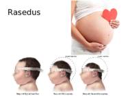 Zika viirus #4