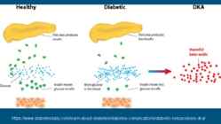 Hyperketonemia producing ketoacidosis #4
