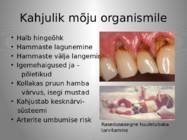 Huuletubakas #4