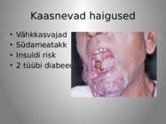 Huuletubakas #5