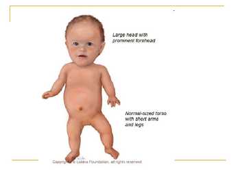 Dwarfism #4
