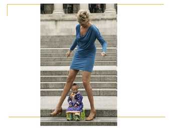 Dwarfism #8