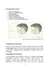 Adenoid #2