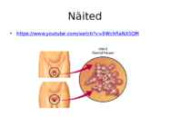 Genitaalherpes #7