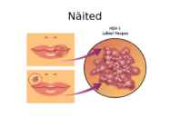 Genitaalherpes #8