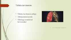 Tubakas #5
