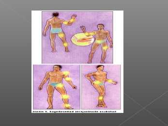 Hemofiilia powerpoint #4