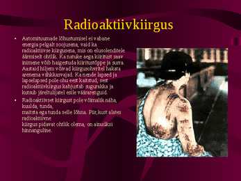 Tuumapomm #7